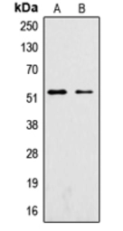 Anti-SGK1 (phospho Ser422) antibody used in Western Blot (WB). GTX32413