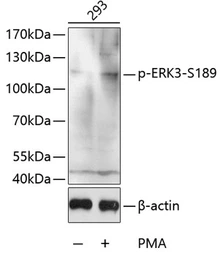 Anti-ERK3 (phospho Ser189) antibody used in Western Blot (WB). GTX32415