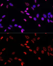 Anti-Histone H3T11ph (phospho Thr11) antibody used in Immunocytochemistry/ Immunofluorescence (ICC/IF). GTX32417