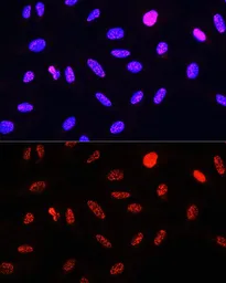 Anti-Histone H3T11ph (phospho Thr11) antibody used in Immunocytochemistry/ Immunofluorescence (ICC/IF). GTX32417