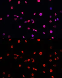 Anti-Histone H3T11ph (phospho Thr11) antibody used in Immunocytochemistry/ Immunofluorescence (ICC/IF). GTX32417