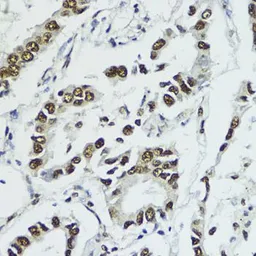 Anti-Histone H3T11ph (phospho Thr11) antibody used in IHC (Paraffin sections) (IHC-P). GTX32417