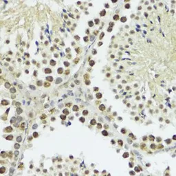 Anti-Histone H3T11ph (phospho Thr11) antibody used in IHC (Paraffin sections) (IHC-P). GTX32417