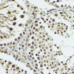 Anti-Histone H3T11ph (phospho Thr11) antibody used in IHC (Paraffin sections) (IHC-P). GTX32417