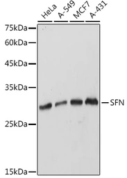 Anti-14-3-3 sigma antibody used in Western Blot (WB). GTX32418