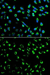 Anti-14-3-3 sigma antibody used in Immunocytochemistry/ Immunofluorescence (ICC/IF). GTX32418