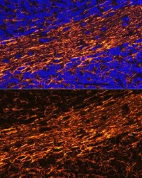 Anti-NF-L antibody used in IHC (Paraffin sections) (IHC-P). GTX32419