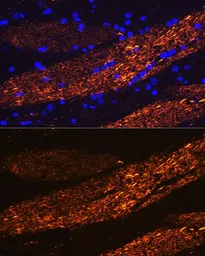 Anti-NF-L antibody used in IHC (Paraffin sections) (IHC-P). GTX32419