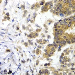 Anti-NF-L antibody used in IHC (Paraffin sections) (IHC-P). GTX32419