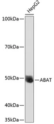 Anti-ABAT antibody used in Western Blot (WB). GTX32420