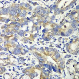 Anti-ABAT antibody used in IHC (Paraffin sections) (IHC-P). GTX32420