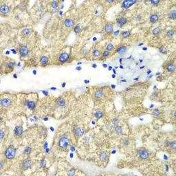 Anti-ABAT antibody used in IHC (Paraffin sections) (IHC-P). GTX32420