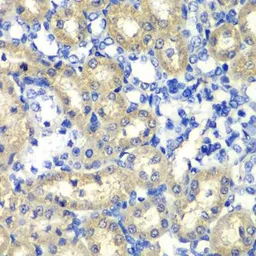 Anti-ABAT antibody used in IHC (Paraffin sections) (IHC-P). GTX32420