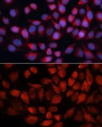 Anti-ACADM antibody used in Immunocytochemistry/ Immunofluorescence (ICC/IF). GTX32421