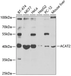 Anti-ACAT2 antibody used in Western Blot (WB). GTX32422