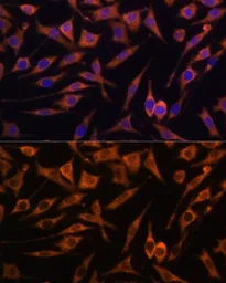 Anti-ACAT2 antibody used in Immunocytochemistry/ Immunofluorescence (ICC/IF). GTX32422