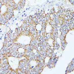 Anti-ACAT2 antibody used in IHC (Paraffin sections) (IHC-P). GTX32422