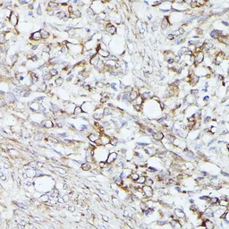 Anti-ACAT2 antibody used in IHC (Paraffin sections) (IHC-P). GTX32422
