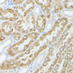Anti-ACAT2 antibody used in IHC (Paraffin sections) (IHC-P). GTX32422