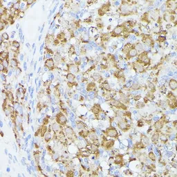 Anti-ACAT2 antibody used in IHC (Paraffin sections) (IHC-P). GTX32422