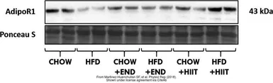 Anti-Adiponectin Receptor 1 antibody used in Western Blot (WB). GTX32425