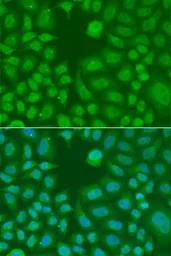 Anti-AES antibody used in Immunocytochemistry/ Immunofluorescence (ICC/IF). GTX32426