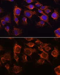 Anti-AIF antibody used in Immunocytochemistry/ Immunofluorescence (ICC/IF). GTX32428