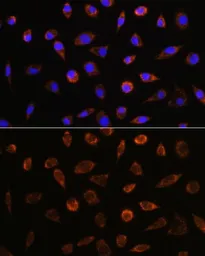 Anti-AIF antibody used in Immunocytochemistry/ Immunofluorescence (ICC/IF). GTX32428