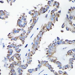 Anti-AIF antibody used in IHC (Paraffin sections) (IHC-P). GTX32428