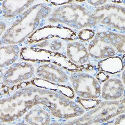 Anti-AIF antibody used in IHC (Paraffin sections) (IHC-P). GTX32428