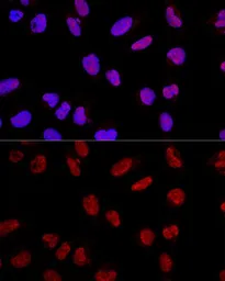 Anti-AKAP8 antibody used in Immunocytochemistry/ Immunofluorescence (ICC/IF). GTX32429