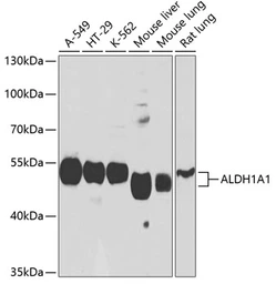Anti-ALDH1A1 antibody used in Western Blot (WB). GTX32431