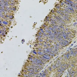 Anti-ALDH1A1 antibody used in IHC (Paraffin sections) (IHC-P). GTX32431