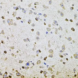 Anti-ALDH1A1 antibody used in IHC (Paraffin sections) (IHC-P). GTX32431