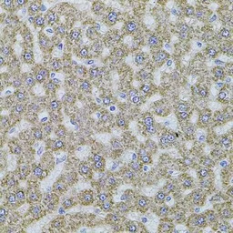Anti-ALDH1A1 antibody used in IHC (Paraffin sections) (IHC-P). GTX32431