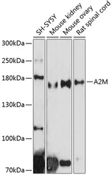 Anti-alpha 2 Macroglobulin antibody used in Western Blot (WB). GTX32434