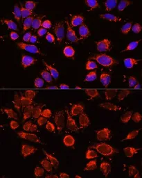 Anti-alpha 2 Macroglobulin antibody used in Immunocytochemistry/ Immunofluorescence (ICC/IF). GTX32434