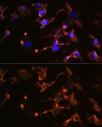 Anti-Amphiphysin antibody used in Immunocytochemistry/ Immunofluorescence (ICC/IF). GTX32438