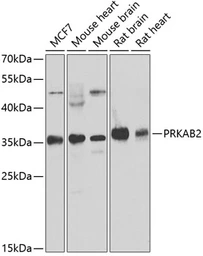 Anti-AMPK beta 2 antibody used in Western Blot (WB). GTX32439
