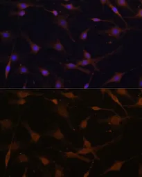 Anti-AMPK beta 2 antibody used in Immunocytochemistry/ Immunofluorescence (ICC/IF). GTX32439
