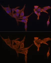 Anti-AMPK beta 2 antibody used in Immunocytochemistry/ Immunofluorescence (ICC/IF). GTX32439