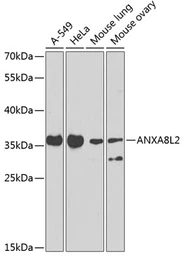 Anti-Annexin A8 like 2 antibody used in Western Blot (WB). GTX32445