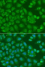 Anti-Annexin A8 like 2 antibody used in Immunocytochemistry/ Immunofluorescence (ICC/IF). GTX32445