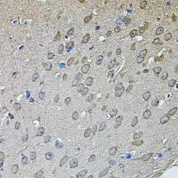 Anti-Annexin A8 like 2 antibody used in IHC (Paraffin sections) (IHC-P). GTX32445
