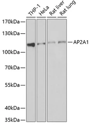 Anti-AP2A1 antibody used in Western Blot (WB). GTX32449