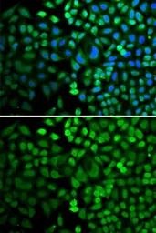 Anti-APE1 antibody used in Immunocytochemistry/ Immunofluorescence (ICC/IF). GTX32451