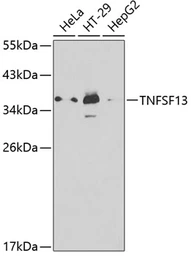 Anti-APRIL antibody used in Western Blot (WB). GTX32453