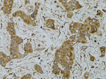 Anti-APRIL antibody used in IHC (Paraffin sections) (IHC-P). GTX32453