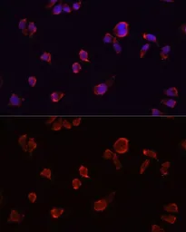 Anti-ARF1 antibody used in Immunocytochemistry/ Immunofluorescence (ICC/IF). GTX32454