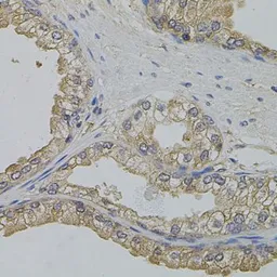 Anti-ARF1 antibody used in IHC (Paraffin sections) (IHC-P). GTX32454